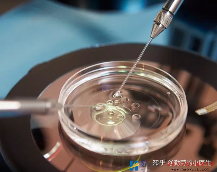 ≥35岁高龄女性的试管婴儿(图3) ≥35岁高龄女性的试管婴儿(图3)