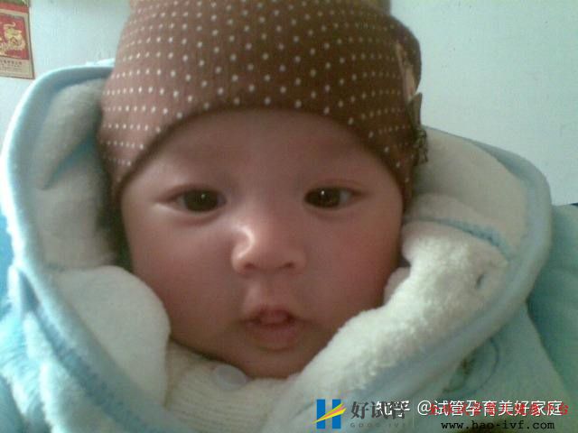 46岁借卵生子成功率高吗高龄供卵试管婴儿案例分享(图3)