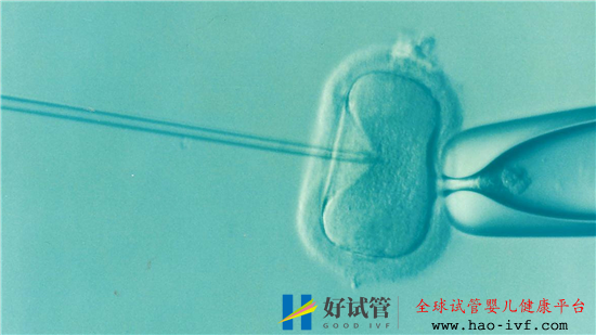 试管婴儿的成功率有多高呢(图1) 试管婴儿的成功率有多高呢(图1)