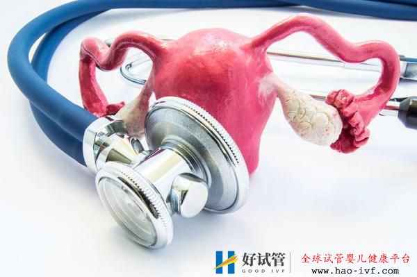 多囊卵巢综合征如何定义?医生:患上多囊卵巢综合征要对症治疗(图1) 多囊卵巢综合征如何定义?医生:患上多囊卵巢综合征要对症治疗(图1)