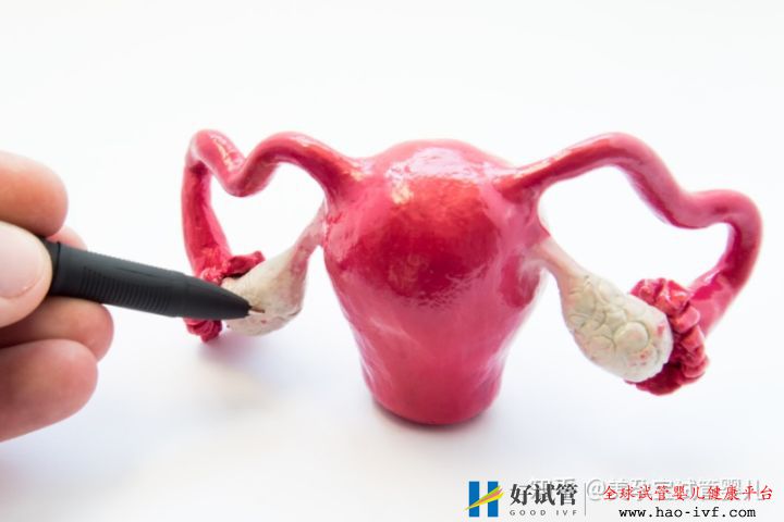 多囊做试管成功率如何不孕不育,多囊国内可以做三...(图2) 多囊做试管成功率如何不孕不育,多囊国内可以做三...(图2)