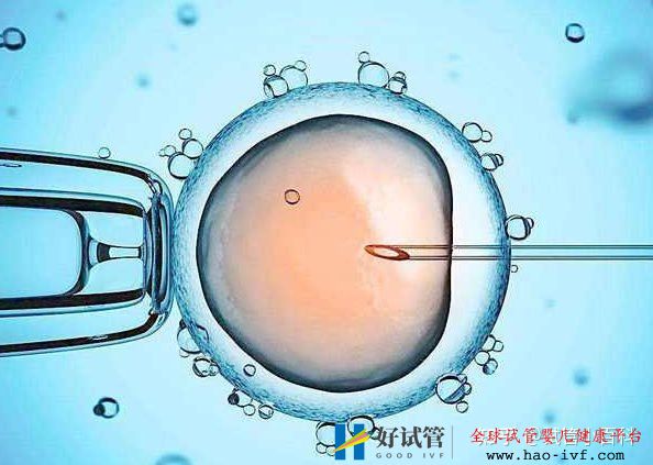 男性患有少精症可以做试管婴儿吗(图1) 男性患有少精症可以做试管婴儿吗(图1)