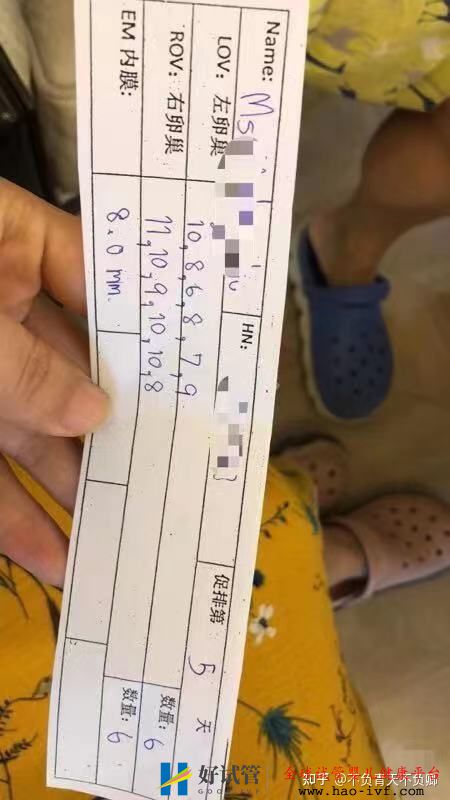 三代试管婴儿全过程之1促排篇(图5) 三代试管婴儿全过程之1促排篇(图5)