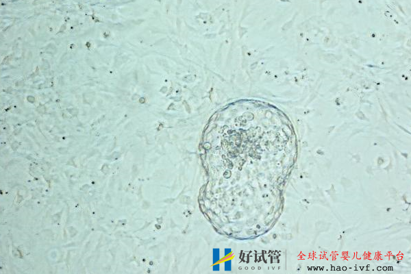美国试管婴儿囊胚培养优势养囊率高低取决于什么?(图2) 美国试管婴儿囊胚培养优势养囊率高低取决于什么?(图2)