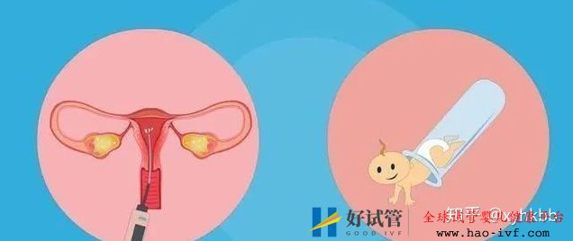 2020泰国第三代试管婴儿双胞胎、龙凤胎的费用降价...(图6) 2020泰国第三代试管婴儿双胞胎、龙凤胎的费用降价...(图6)