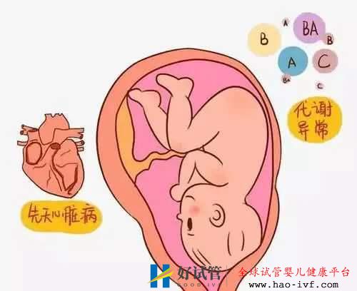 试管婴儿可以杜绝先天性心脏病吗?这个答案你得知道(图1) 试管婴儿可以杜绝先天性心脏病吗?这个答案你得知道(图1)