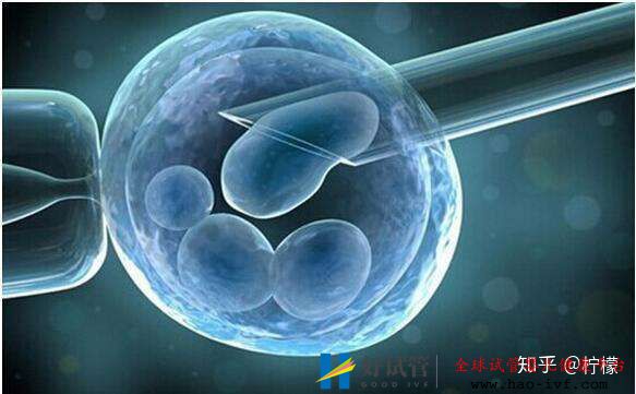 试管婴儿,女性到底在承受什么(图1) 试管婴儿,女性到底在承受什么(图1)