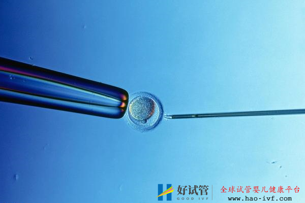 去美国做试管婴儿生双胞胎的概率(图2) 去美国做试管婴儿生双胞胎的概率(图2)