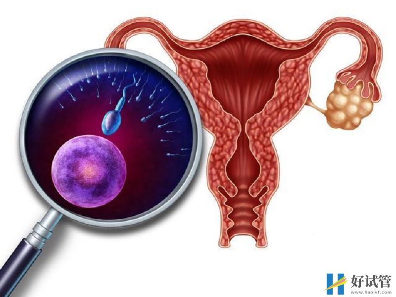 FSH正常值出现偏差需注意,搞不好是卵巢早衰找上门!(图1) 卵泡生成激素正常值说明