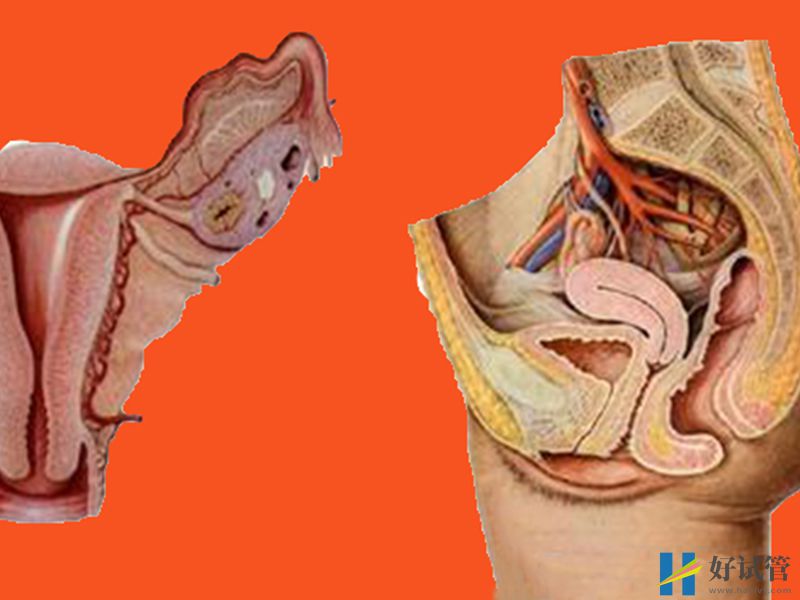 纵隔子宫的原因众多,但多数都是先天性引起的(图2) 纵膈子宫的检查方法