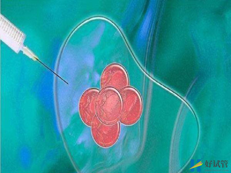 美国试管助孕费用不菲!在美日常消费也不便宜(图1) 囊胚移植