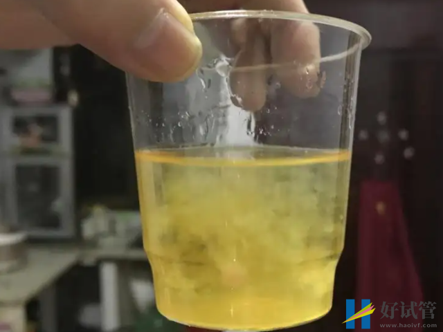 孕妇尿液加醋测男女步骤分享,找准诀窍才不易翻盘(图2) 白醋加尿液混合物变浑浊是男孩