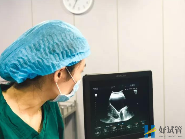 49计算法测男女超准公式分享,掌握推算口诀是关键(图1) 医学禁止非法查看胎儿性别