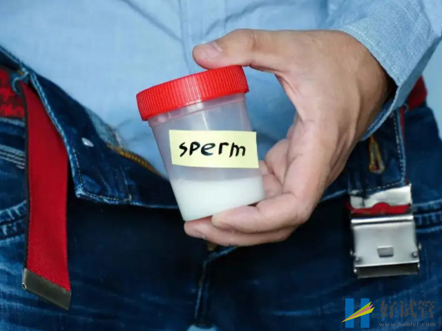 昆明正规医院供卵试管费用明细,一般家庭也承担得起(图4) 取精前注意禁欲3至7天