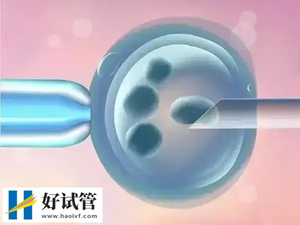 马来西亚第三代试管婴儿优势有哪些？NGS筛查准确率可达99%(图3)