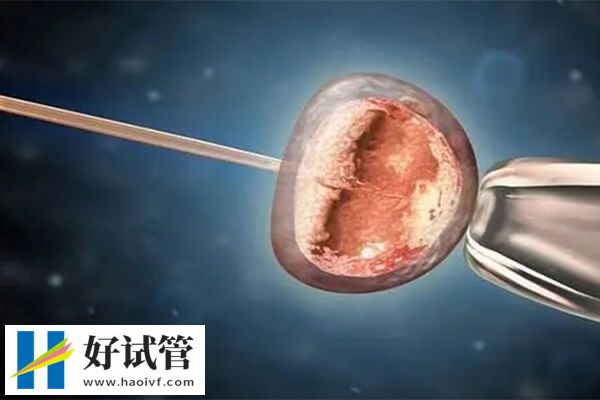 宿迁妇保院试管婴儿龙凤胎需要多少钱(图1) 宿迁妇保院试管龙凤胎约3-5万元