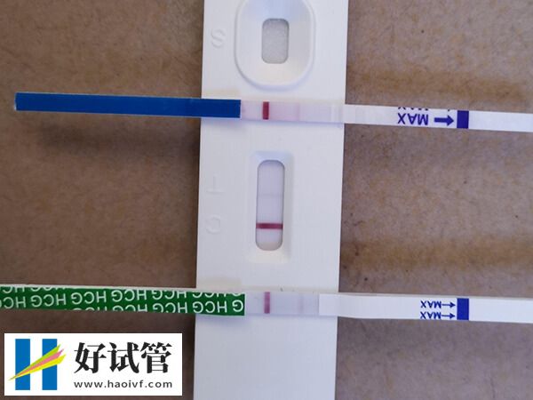 单囊胚移植不光能减少并发症,女性经济、身体压力也会变小(图3) 单囊胚移植的好处