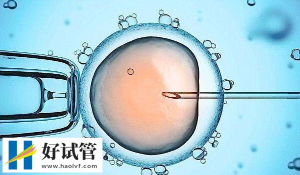 秦皇岛妇幼保健院怎么样?附开展的试管婴儿技术说明(图1) 秦皇岛妇幼保健院能做试管婴儿
