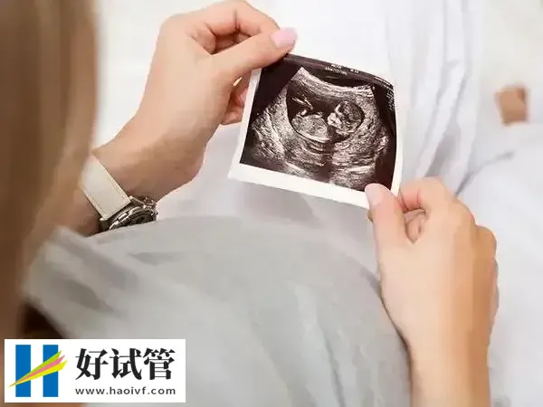 唐氏综合征筛查方式有哪些(图1) 无创DNA检查唐氏综合征准备比较高