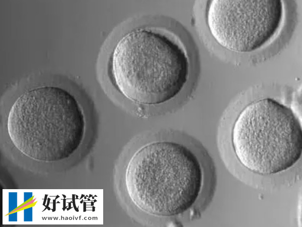 试管移植需要攒几个胚胎(图1) 攒够4-5个胚胎才能进行移植