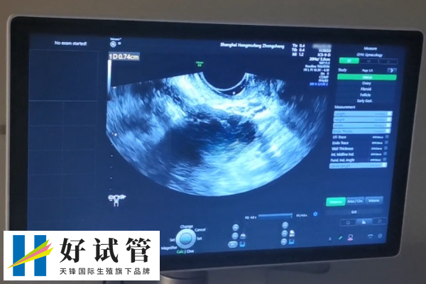 女性做试管期间检查阴超的次数(图2) 妊娠第30-35天和40-45天进行的阴超检查