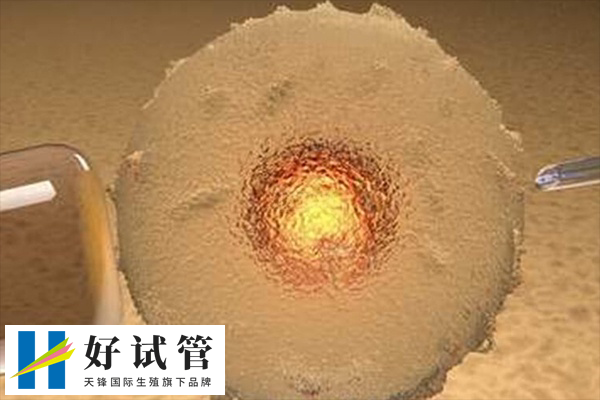 前往俄罗斯做试管合不合法(图1) 俄罗斯试管婴儿是合法的