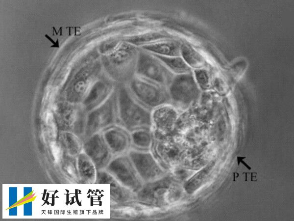 做试管培养囊胚有哪些好处(图1) 囊胚和子宫内膜的发育周期更加同步