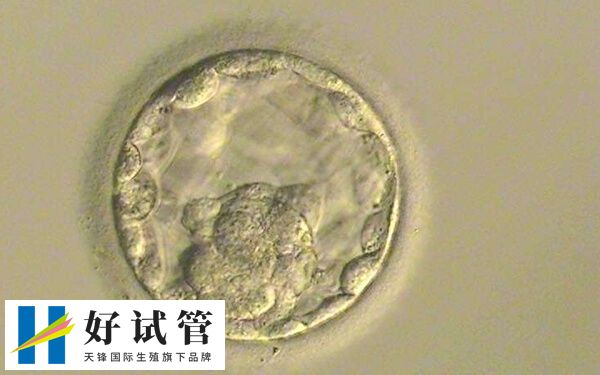 移植囊胚会不会失败(图2) 试管囊胚移植失败的原因较多