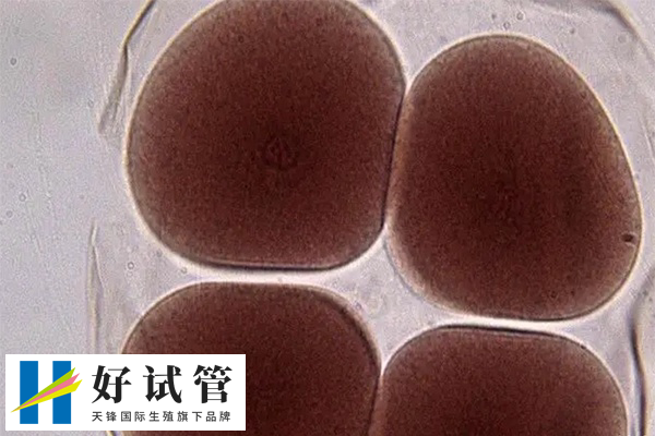 试管基础卵泡质量和数量哪个影响更大(图1) 基础卵泡质量比数量更能影响试管成功率