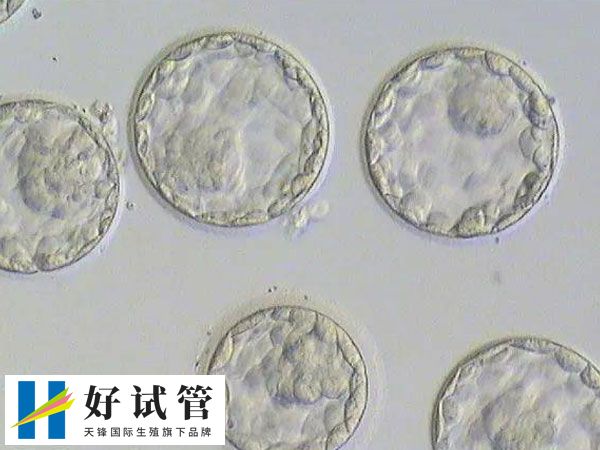 囊胚移植的成功率高于三天胚胎