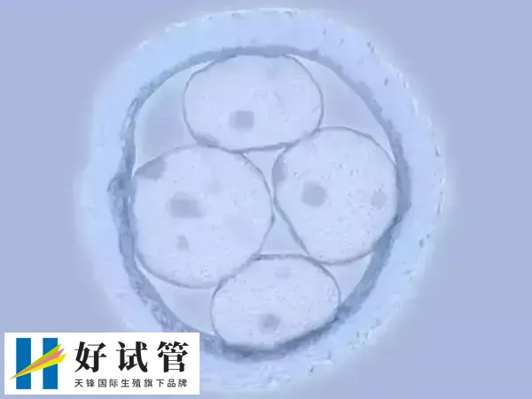 胚胎移植后男性能做些什么(图1) 胚胎移植后女性要多注意休息