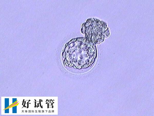 6aa囊胚的成功率高不高(图1) 囊胚6AA是优质评级