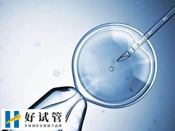 试管婴儿短方案一共要去医院几次(图2) 短方案的治疗周期通常为10-15天左右